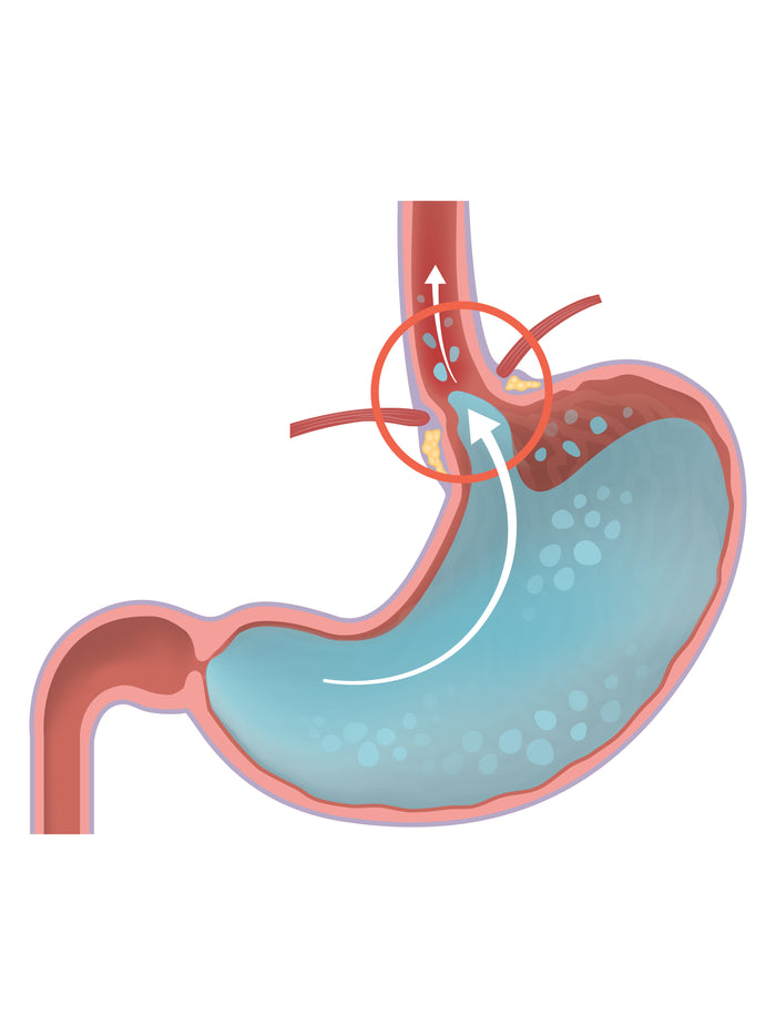 Why GastroAid® works