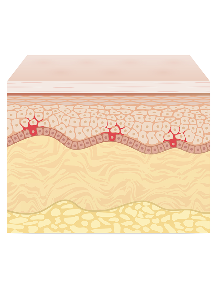 Why Skin Saviour® works