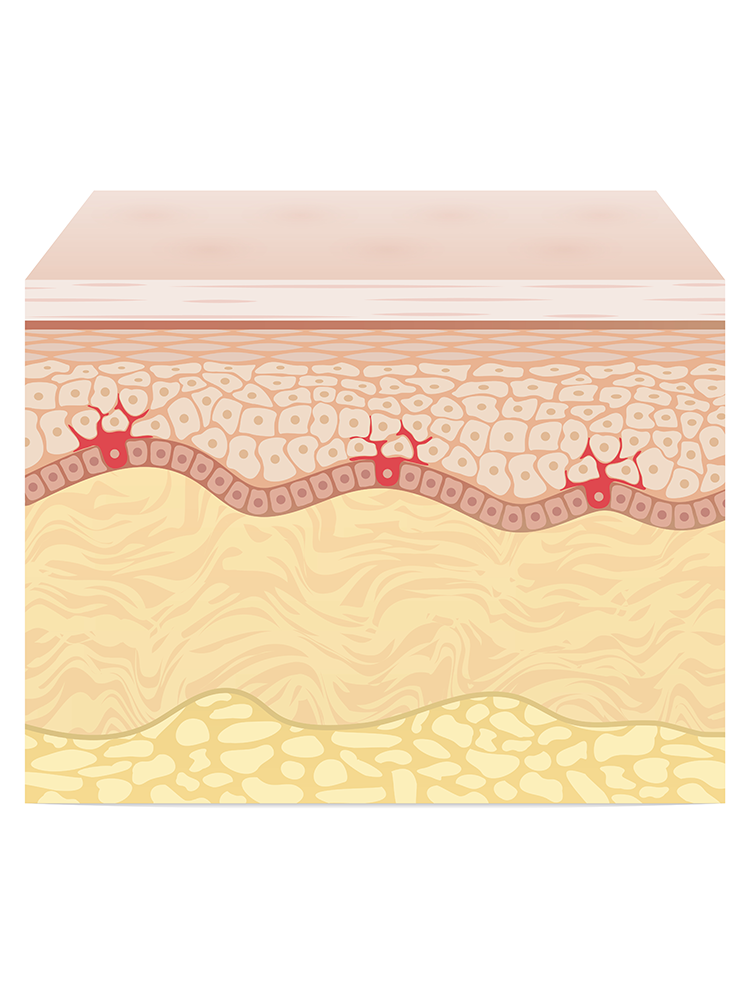 Why Skin Saviour® works